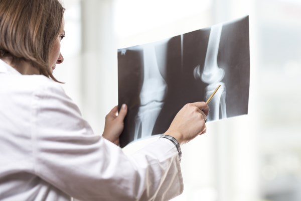 Have You Sustained an Auto Injury?