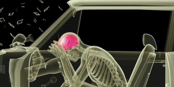 Advantages of Hiring a Car Accident Attorney in Mobile, Alabama 1 Mobile Alabama Injury Attorney - Why You Should Hire An Attorney After A Car Wreck